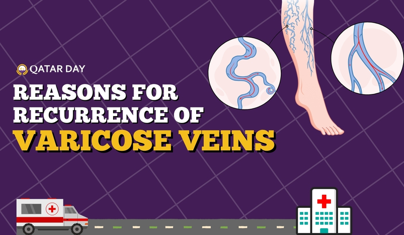 Reasons for Recurrence of Varicose Veins